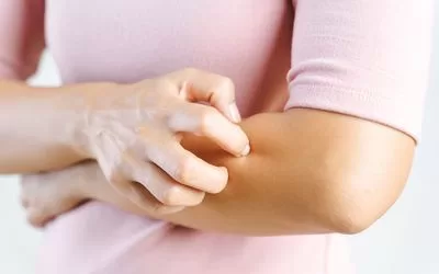 SUS: Tratamento Integral para Dermatite Atópica