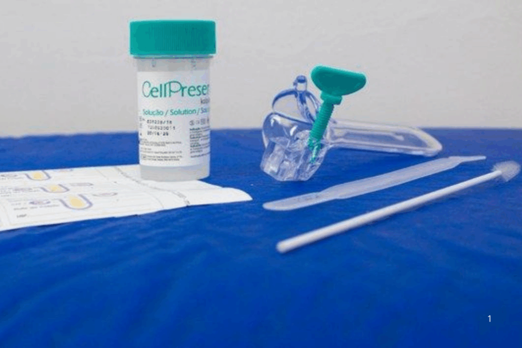 PRECISÃO: Teste DNA-HPV 100% Nacional Para Detectar Câncer do Colo do Útero no SUS