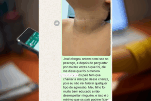 PRECONCEITO: Dois Dedos de Criança Brasileira São Decepados na Escola de Portugal