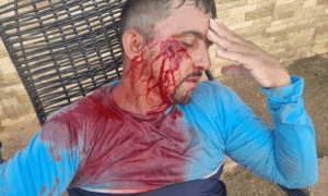 AGRESSÃO: Gari Foi Agredido ao Recusar Coleta de Vidro Perigoso em Rio Branco