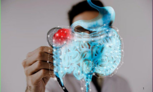 PREVENÇÃO: SUS Adota Novo Exame para Detectar Câncer de Intestino Antes dos Sintomas